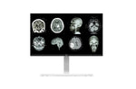 Load image into Gallery viewer, LG 27 (68.58cm) UHD 8MP Clinical Review Monitor
