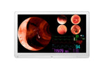 Load image into Gallery viewer, LG 31.5 (80.01cm) 4K IPS Surgical Monitor
