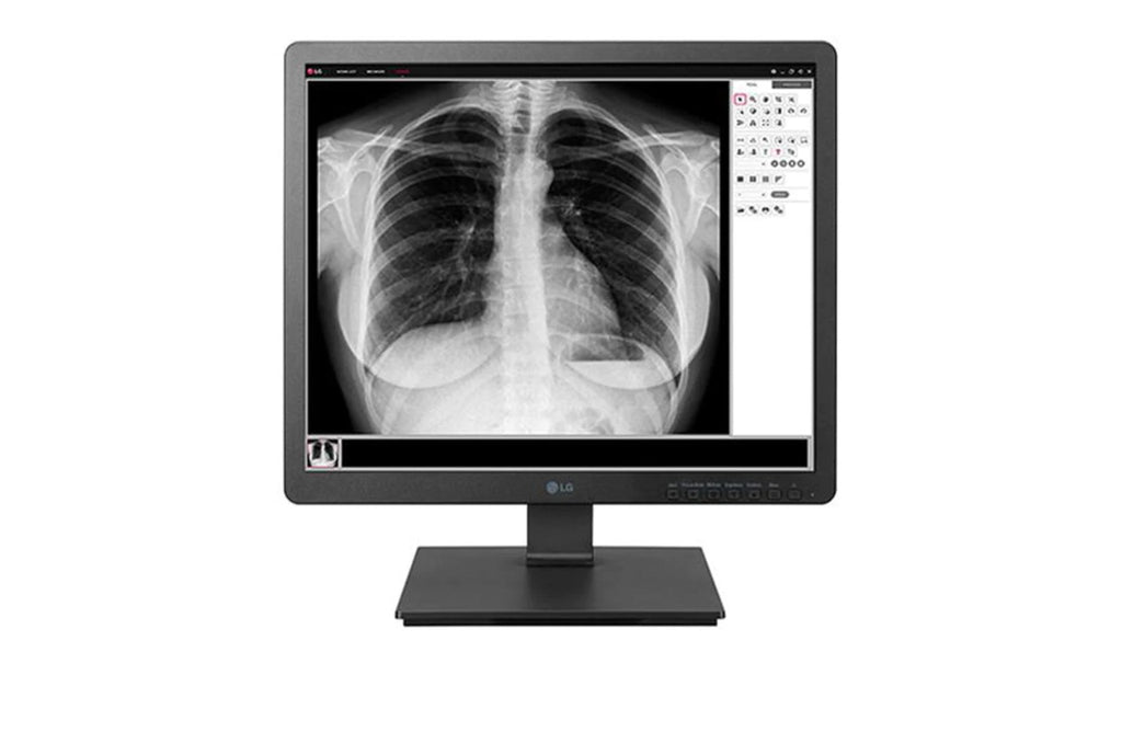 LG 19 (48.26cm) 1.3 MP Clinical Review Monitor 1280 x 1024